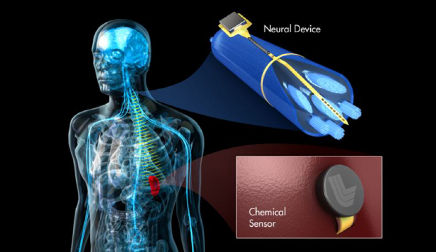 Conceptual image of a complete neurostimulator and sensing system. this work focuses on developing a prototype of an implantable device for peripheral nerve stimulation. future work will be to combine the device with other on-going laboratory work developing implantable chemical sensors.